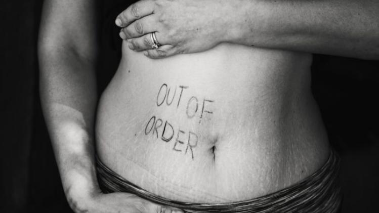 abdomen-belly-black-and-white-735966-696x465